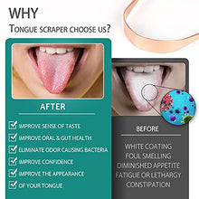 Load image into Gallery viewer, Copper Tongue Scraper with Travel Case (2 Pack), 100% Pure Copper,Naturally Anti-Microbial, Banishes Bad Breath and Maintains Oral Hygiene, Tongue Cleaner for Adults and Kids, Easy to Use and Clean